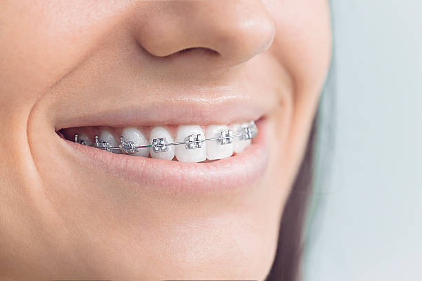Why Choose Us for Your Dental Needs in Ogden, UT